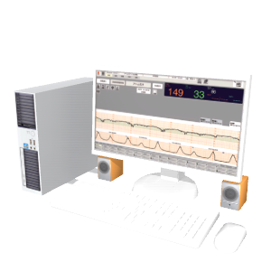 医療機器 AO胎児監視システムME01