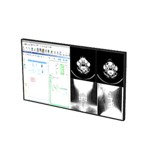 医療機器 モニタME06