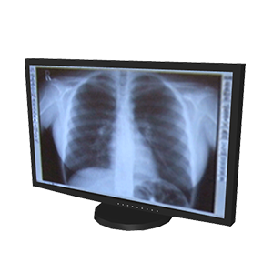 医療機器 モニタMP01